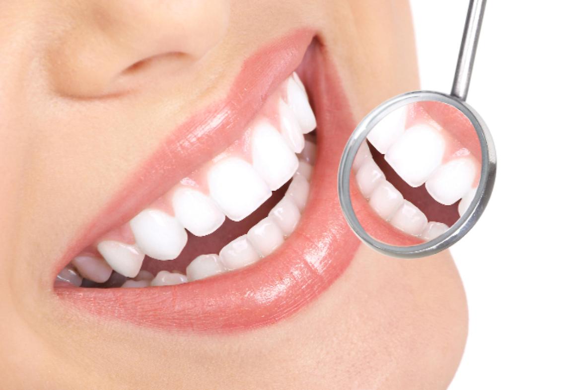Un sorriso veramente “trasparente”