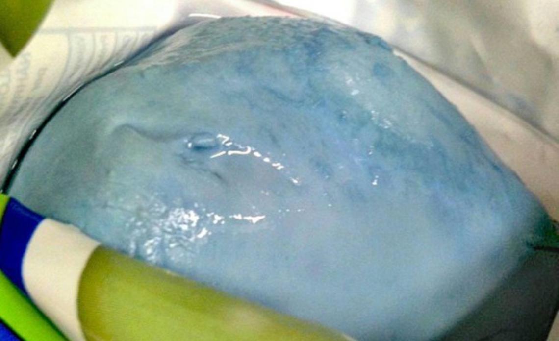 CHIERI. Famiglia trova "mozzarelle blu".
