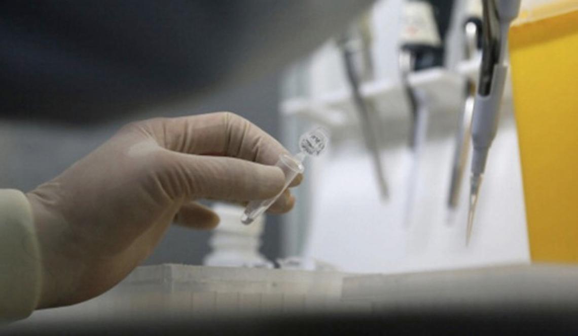 ASTI. Ragazzo 'progetta' farmaco anti-Ebola
