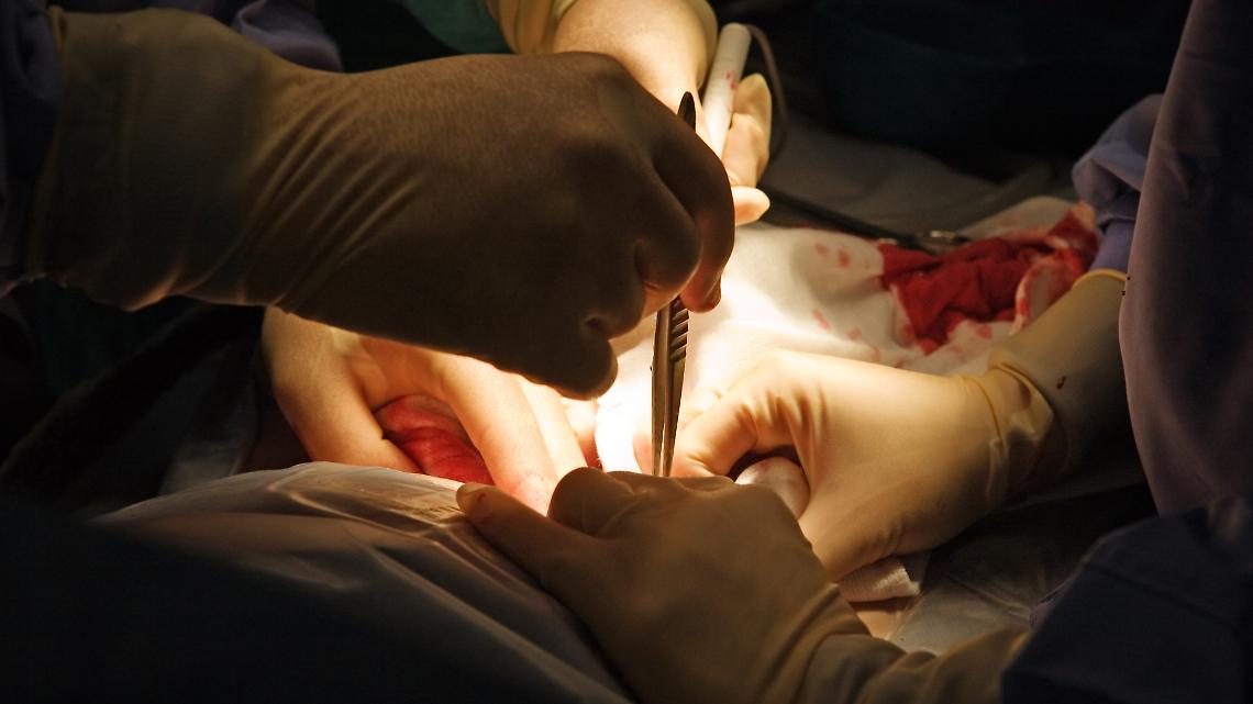 Miracolo a Torino: donna sopravvive senza fegato! Corsa contro il tempo per e un donatore dall'altra parte d'Italia