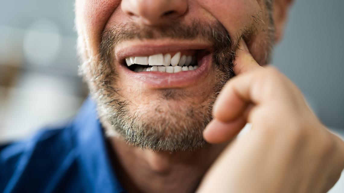 A Ivrea cure odontoiatriche gratuite per chi non ha soldi