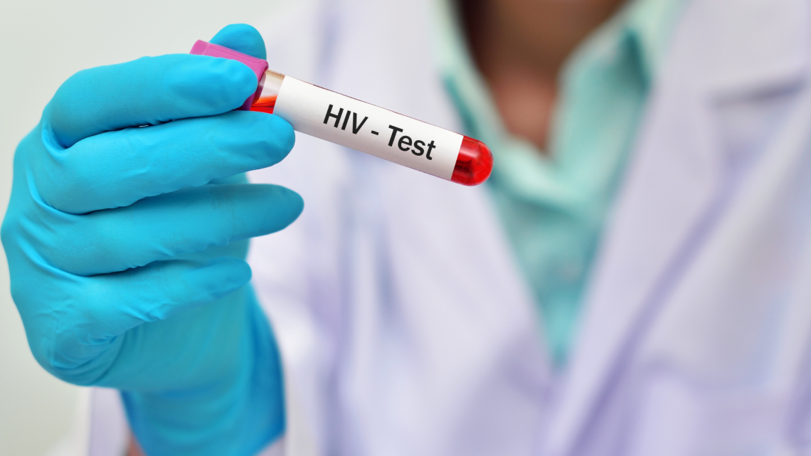 HIV