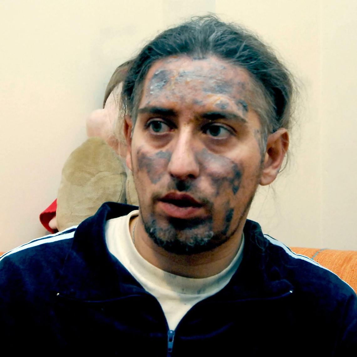Antonio Boccuzzi, che quella maledetta notte tra il 5 e il 6 dicembre del 2007 si salvò grazie a un muletto che l’ha protetto dal rogo divampato alla Thyssenkrupp di Torino dove trovarono la morte set