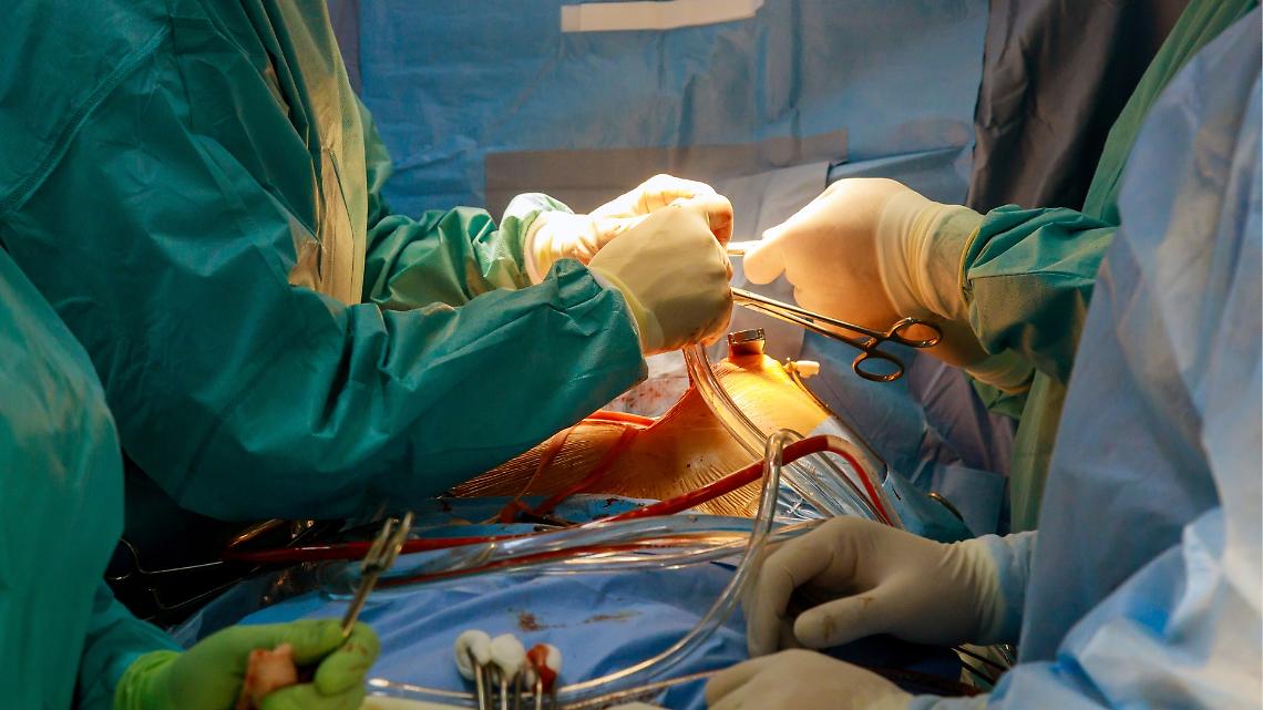 San Giovanni Bosco, impiantata protesi aortica in un uomo con cuore invertito