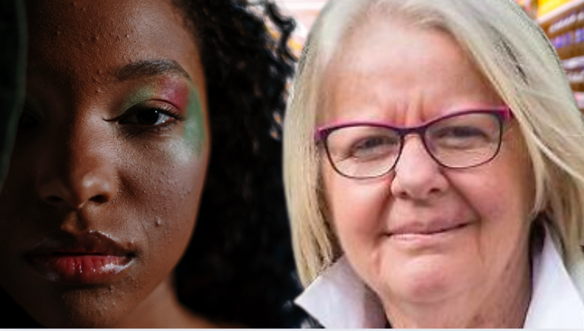 Aggressione razzista, l’assessora Colosso: "Ivrea è inclusione, non odio"