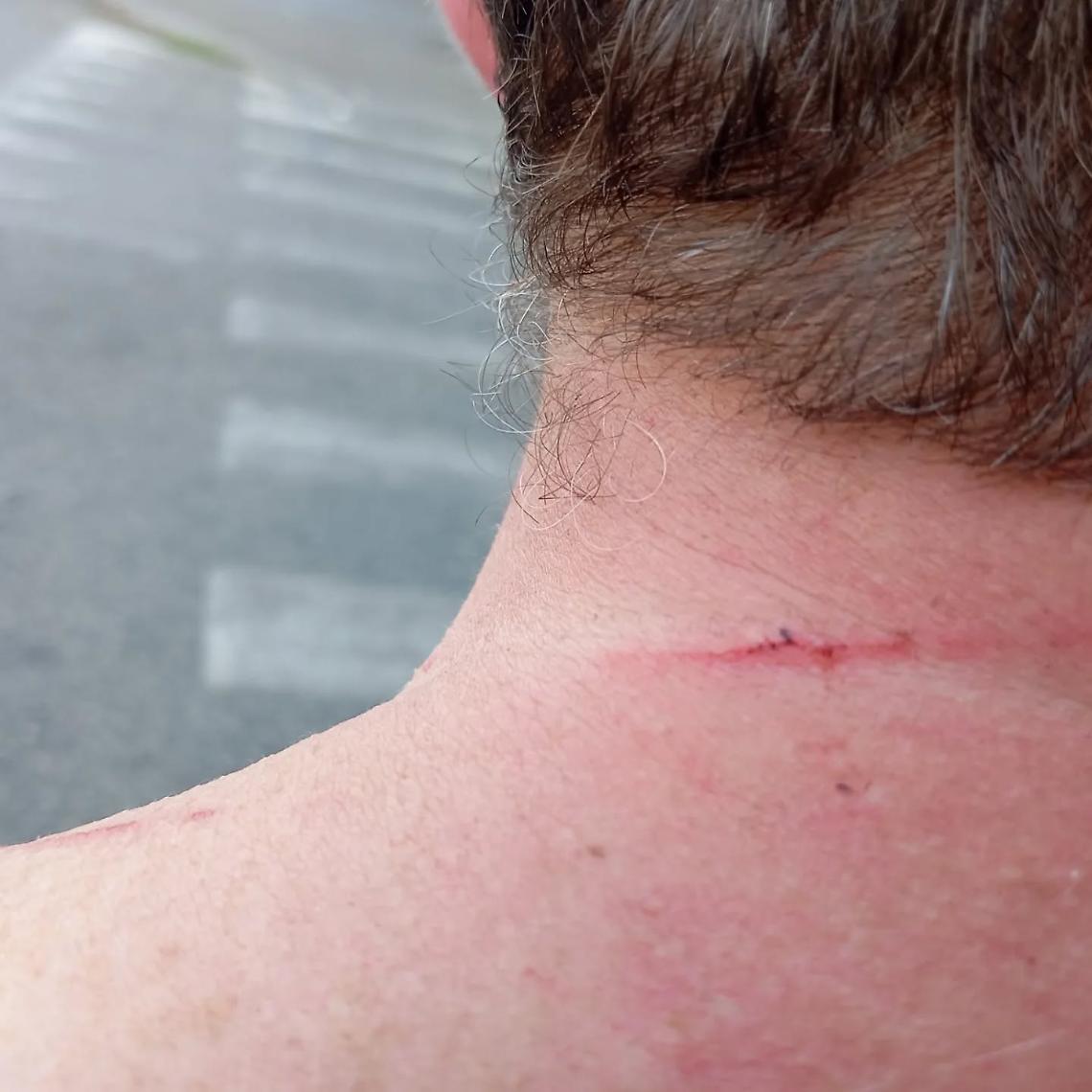 Collana strappata da tre uomini in fuga su monopattino: Barriera di Milano ancora ostaggio dei rapinatori! 