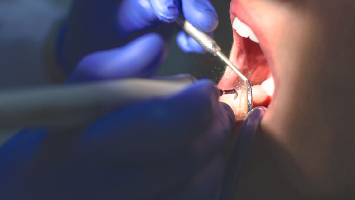 Falso dentista curava in nero: sigilli e maxi multa a Ciriè