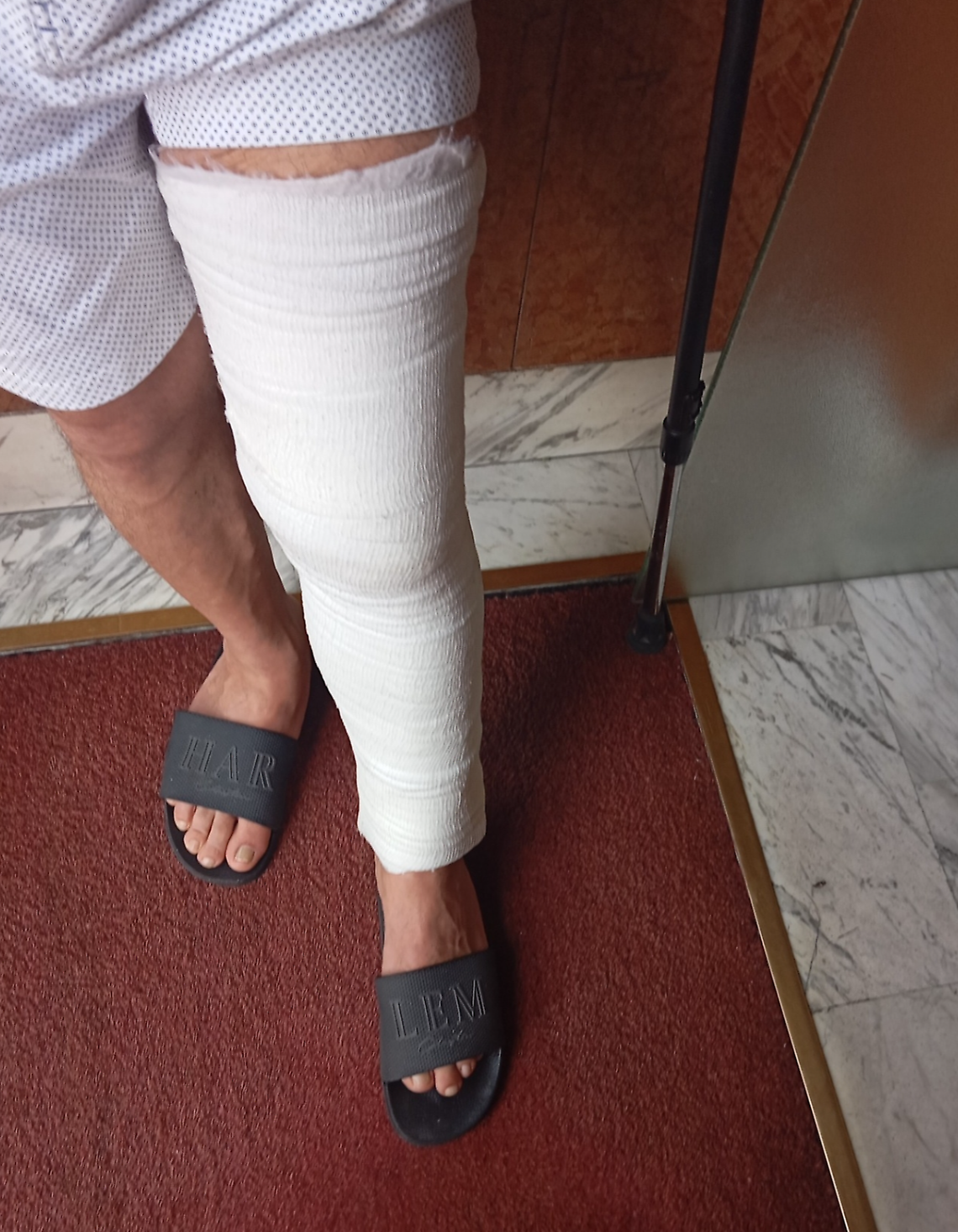 Rapina in monopattino a Barriera: dipendente Stellantis finisce in ospedale con rotula fratturata