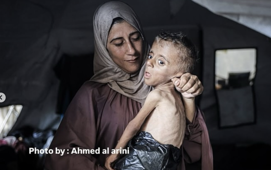Coop lancia #CoopforGaza: 500.000 euro per sostenere Medici Senza Frontiere