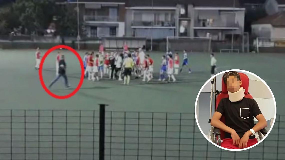 13enne picchiato a Collegno, l'aggressore risponde: "Mi scuso, ma non è andata così"