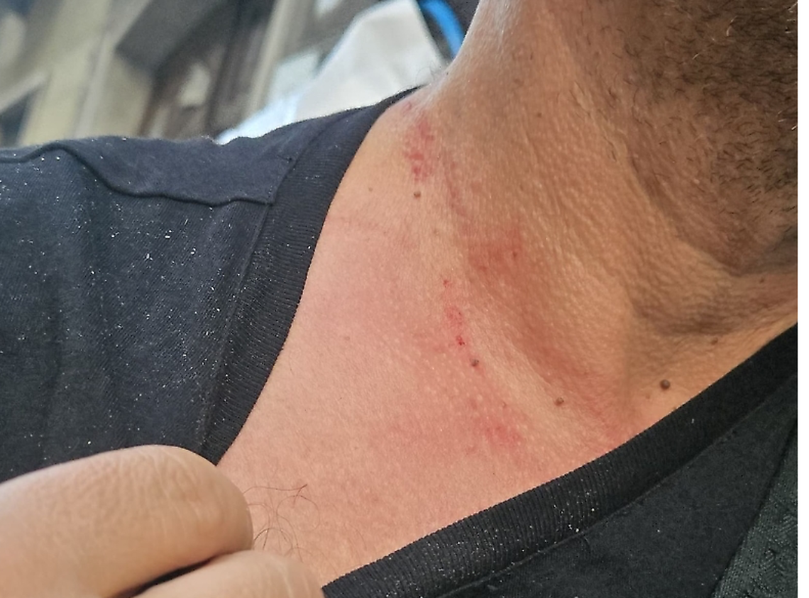 Torino fuori controllo: ragazzo aggredito e picchiato per una collana d’oro