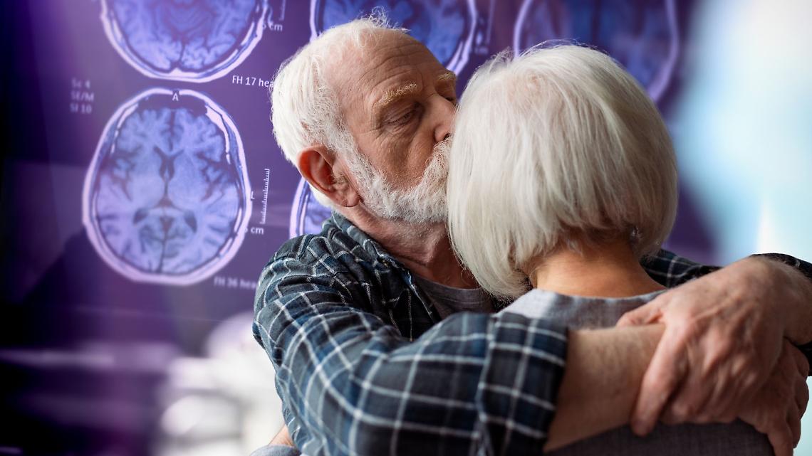 Alzheimer in Italia