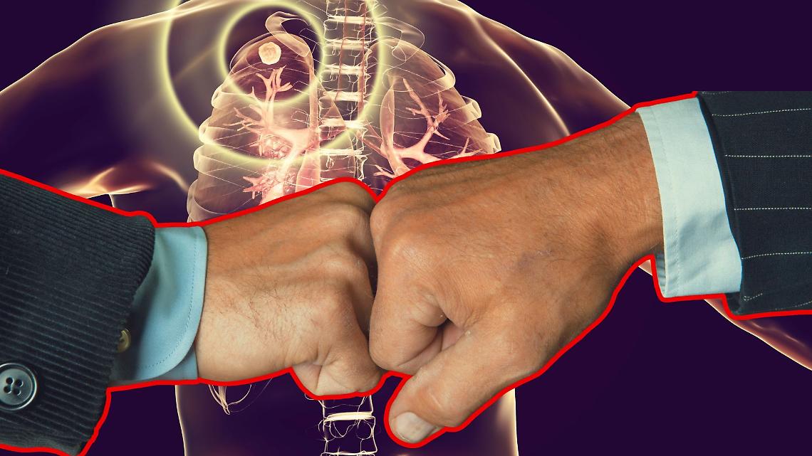 Focolaio di tubercolosi