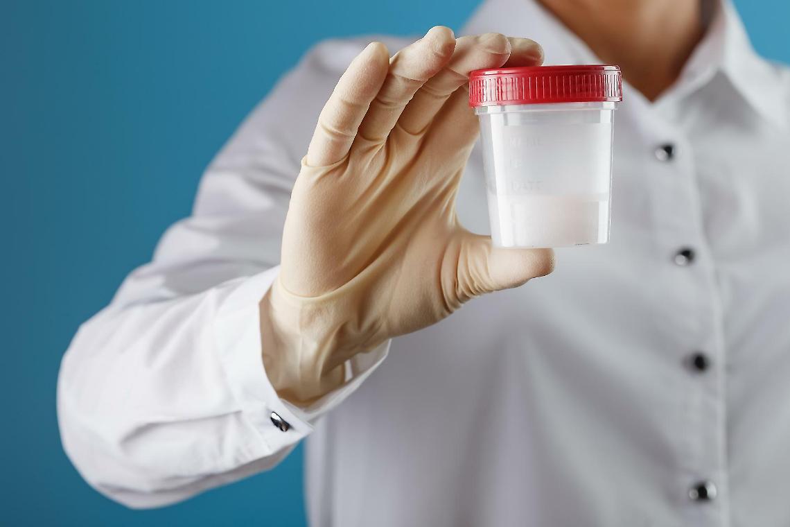 Scandalo della Banca dello sperma: il donatore “Kjeld” con mutazione TP53 e quasi 200 bambini a rischio tumore in 14 Paesi