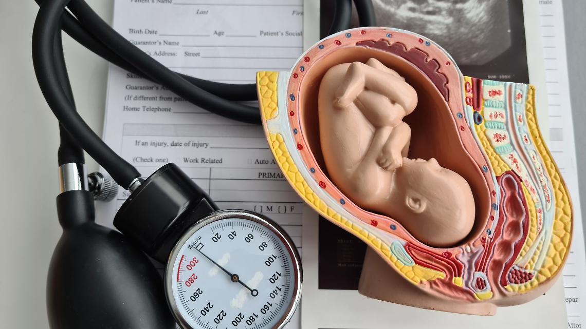 Aborto farmacologico