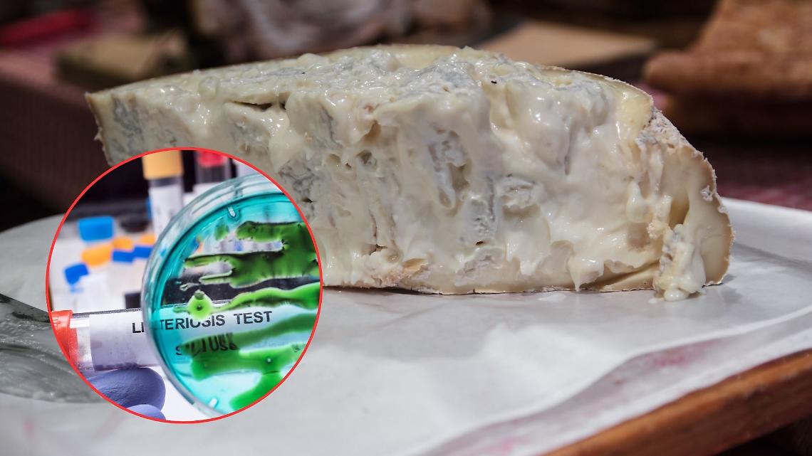 Listeria nel gorgonzola