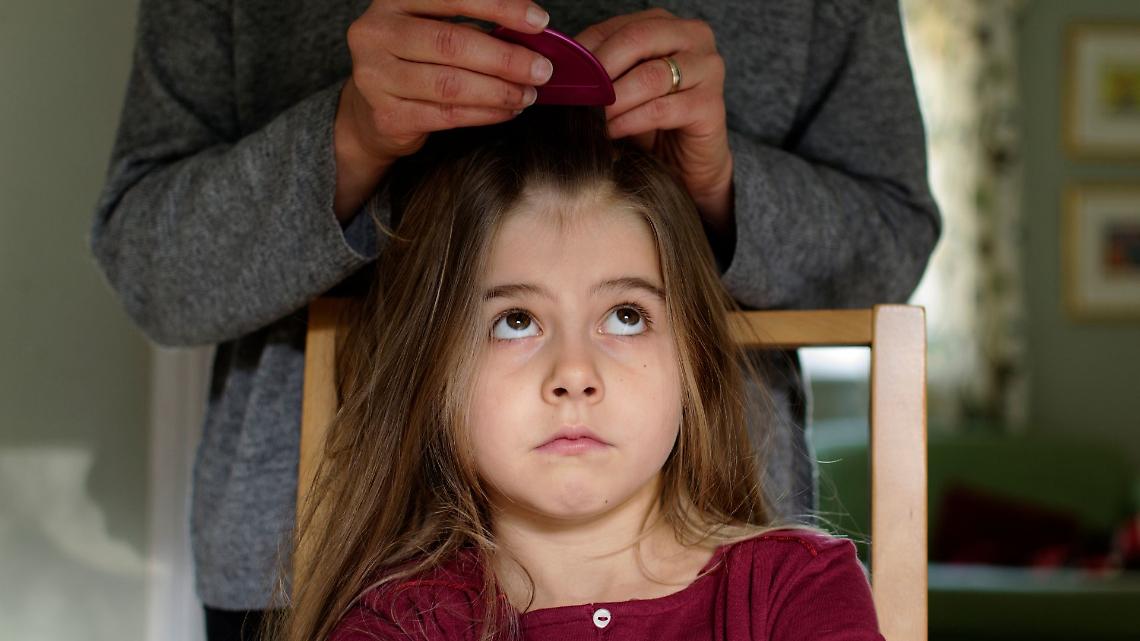 San Mauro, pidocchi senza fine a scuola: &ldquo;Sistema fermo, famiglie esasperate&rdquo;