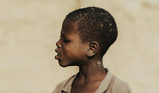 Sud Sudan, 1,9 milioni di sfollati a rischio: tagli agli aiuti, fame e colera mentre mancano 1,5 miliardi di dollari