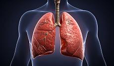 Tumore al polmone