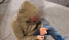 Rissa choc in corso Torino