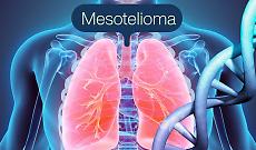 Mesotelioma