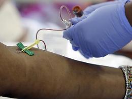 ROMA. Tumori del sangue, migliora la sopravvivenza in Europa