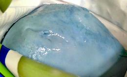 CHIERI. Famiglia trova "mozzarelle blu".
