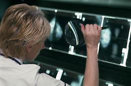 TORINO. Tumori: effetto protetti sigmoidoscopia in test screening