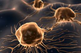 TORINO. Tumori: neoplasie cavo orale, domani visite preventive
