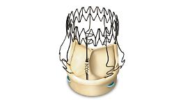 SALUGGIA. LivaNova sposta in Canada la produzione di valvole biologiche