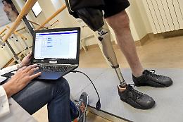 Solo chi ha i soldi può avere un ginocchio "elettronico"? La Sanità pubblica dov'è?