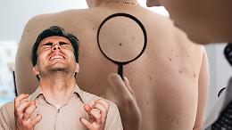 La dermatologia non c'è più. Visita specialistica tra un anno a Domodossola