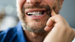 A Ivrea cure odontoiatriche gratuite per chi non ha soldi