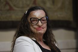 "Ditemi se questi sono maltrattamenti": la storia di Filomena Lamberti, sfregiata con l'acido dall'ex marito