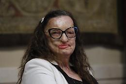 La storia di Filomena Lamberti, prima donna sfregiata con l’acido in Italia 