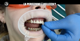 Il sorriso da Star Hollywoodiana:  l'ascesa dell'American Smile tra i giovani