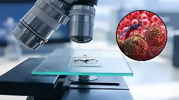 Allarme malaria in Italia: il caso dell'uomo rientrato dal Congo 