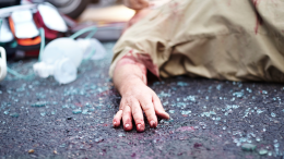 Pirata della strada nella notte di Capodanno: giovane travolto in via Sansovino