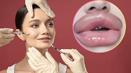 Finti medici estetici: laboratori abusivi nelle case, filler low cost e rischi altissimi