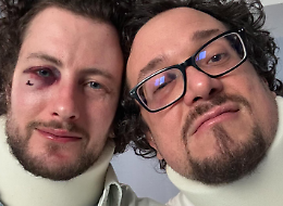 “Siamo stati aggrediti in via Po perché gay”. Il post di Mattia diventa virale: “L’Italia è bella, ma può ucciderti”