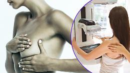  Mammografie anche il sabato, Torino accelera: la prevenzione non può essere rimandata!