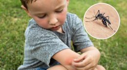 Virus West Nile: ecco cosa sappiamo, come si trasmette e come proteggersi davvero