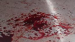 Chivasso sotto shock: uomo si ferisce da solo, crolla in strada in una pozza di sangue