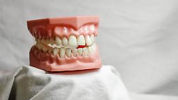Chiude il centro Dentorino: pazienti senza cure e soldi persi
