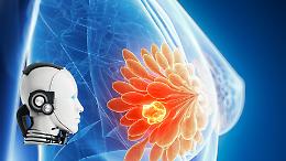 Tre studentesse creano una IA per diagnosticare precocemente il tumore al seno