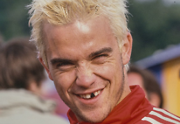 “Ho perso peso, ma anche la vista”: Robbie Williams e il lato oscuro delle iniezioni dimagranti