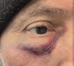 Aggressione shock al supermercato: cliente disabile aggredito senza motivo