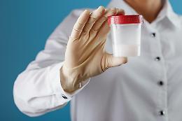 Scandalo della Banca dello sperma: il donatore “Kjeld” con mutazione TP53 e quasi 200 bambini a rischio tumore in 14 Paesi