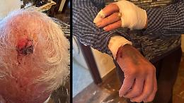 Si arrampica, fracassa il vetro e aggredisce un 86enne: il quartiere torinese sprofonda nel caos della microcriminalità