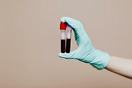 Prelievi del sangue sotto casa: Ivrea porta la sanit&agrave; nei quartieri